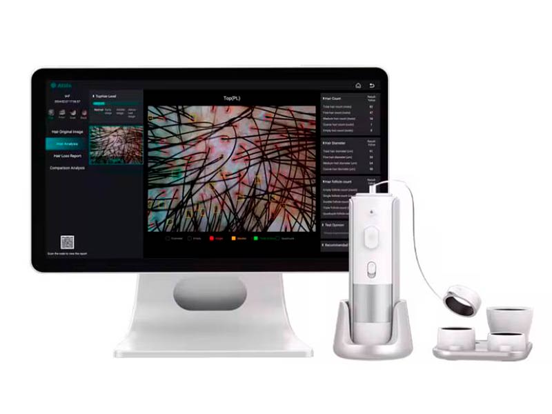Microcamera per Capelli con Intelligenza Artificiale Integrata