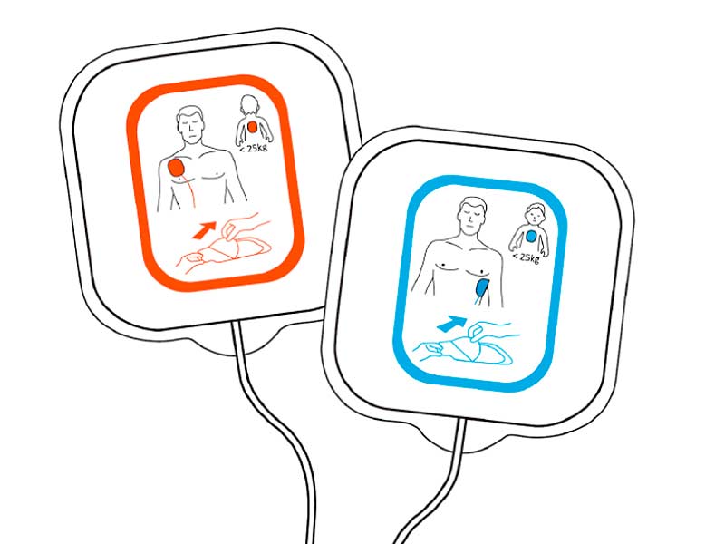 Parches para desfibrilador REANIBEX 100, adultos y pediátricos