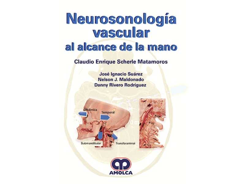 Foto_variante