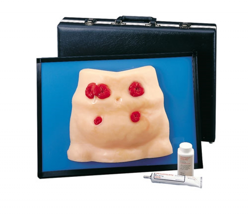 Modelo para cuidados de ostomias