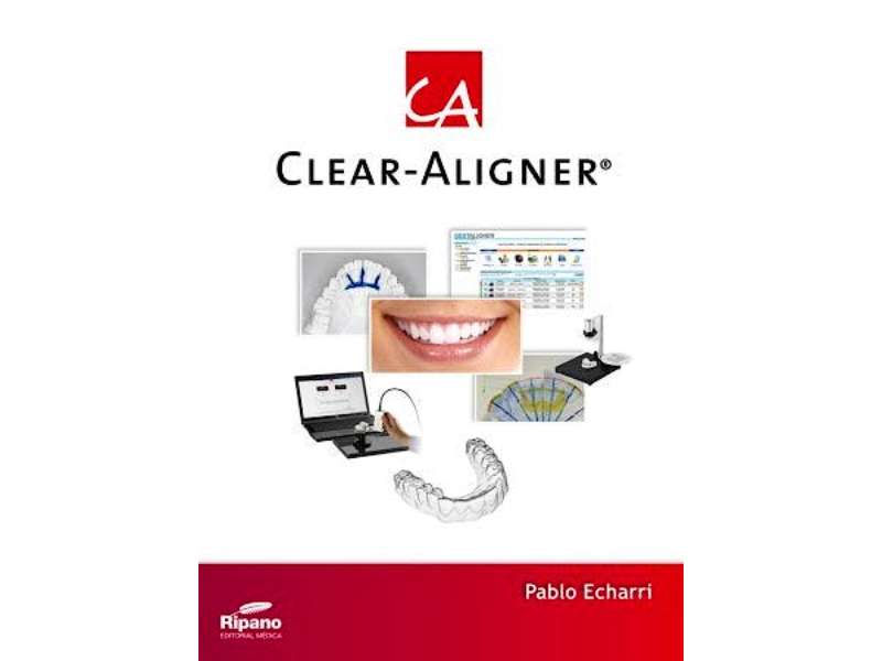 Clear Aligner