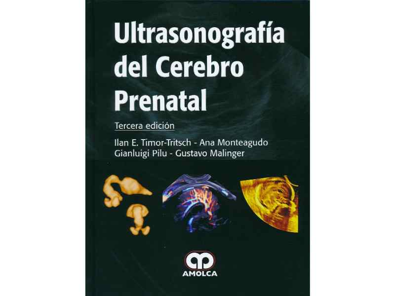 Foto_variante