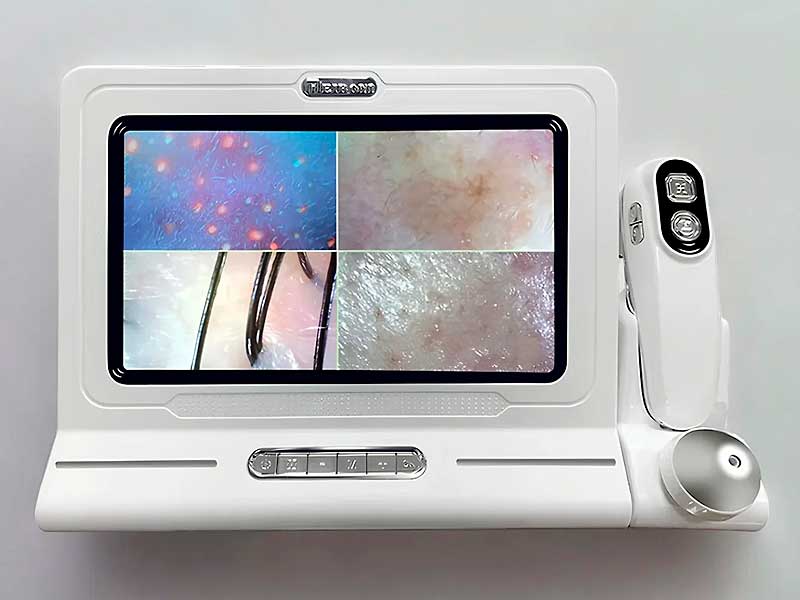 Analisador Capilar Hair Diagnostic branco