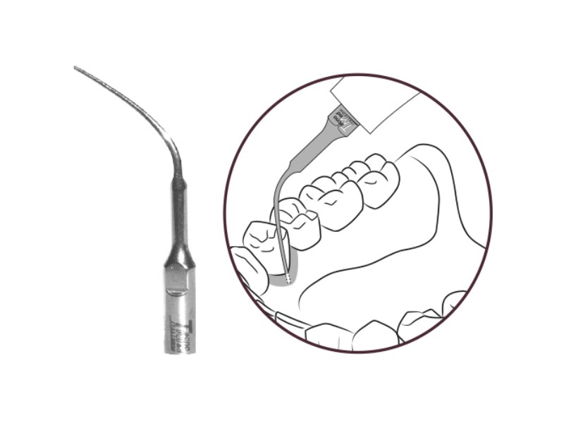 Inserto parodontal compatible Mectron P10 modèle PG072M acier inoxydable