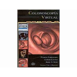 Colonoscopia Virtual