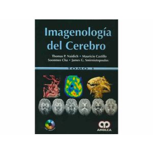 Foto_variante