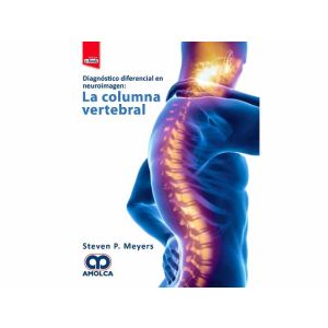 Foto_variante