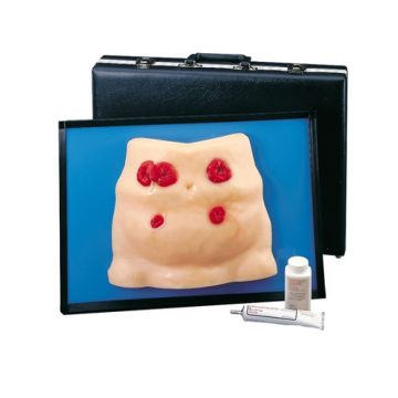 Υπόδειγμα για τη φροντίδα των ostomies